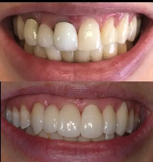 Before & After Gallery image
