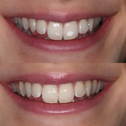 Before & After Gallery image