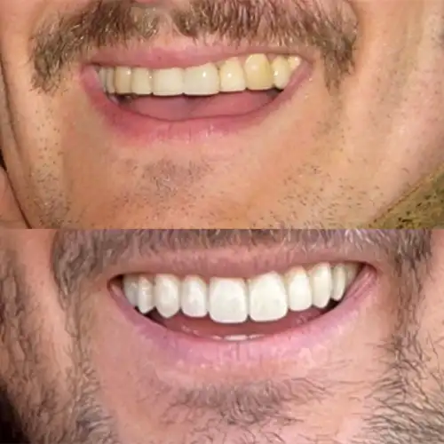 Before & After Gallery image