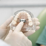 MARPE is an advanced orthodontic treatment
