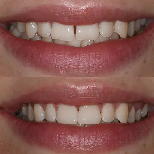 Before & After Gallery image